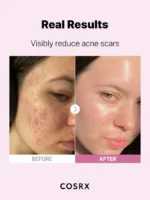 CosRx, The Niacinamide 15 Serum, 20ml - Image 3