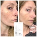 The Ordinary Alpha Arbutin 2% + HA, 30ml - Image 2