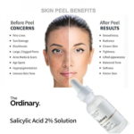 The Ordinary - Niacinamide 10% + Zinc 1%, 30ml - Image 3