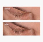 The Ordinary Multi-Peptide Lash and Brow Serum - Image 2