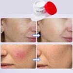 Kojic Acid Melanotech Face Cream Deep Nourishment 7 Days, 50g - Image 3