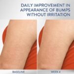 Cetaphil Daily Moisturizer Smoothing for Rough, Bumpy Skin, 296 ml - Image 3