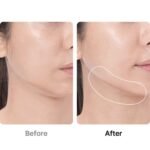 Medicube AGE-R Booster Pro - Image 3