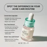 Axis-Y Spot The Difference Blemish Treatment 15ml - Image 2