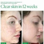 Axis-Y Spot The Difference Blemish Treatment 15ml - Image 3