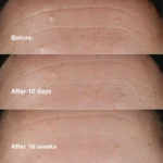 Clinique Smart Clinical Repair Wrinkle Correcting Serum 50 ml - Image 3